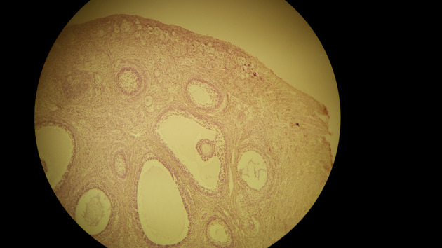 Ovary Graafian Follicle Slides - Ovary Graafian Follicle 006 100X